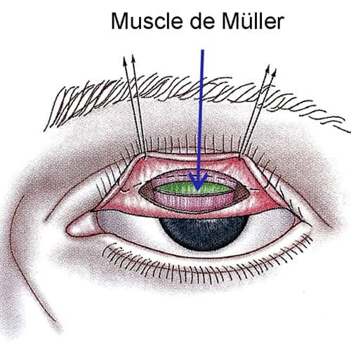 muscle muller paupiere superieure chirurgien ophtalmologue paupieres paris docteur florence pouget theron paris